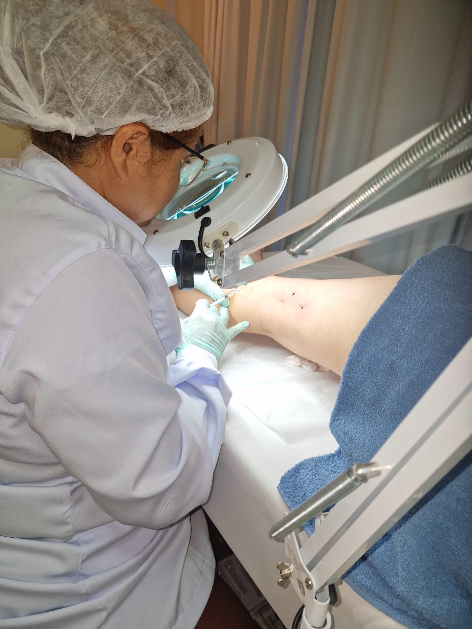 Aplicação de glicose hipertônica em microvasos com lupa