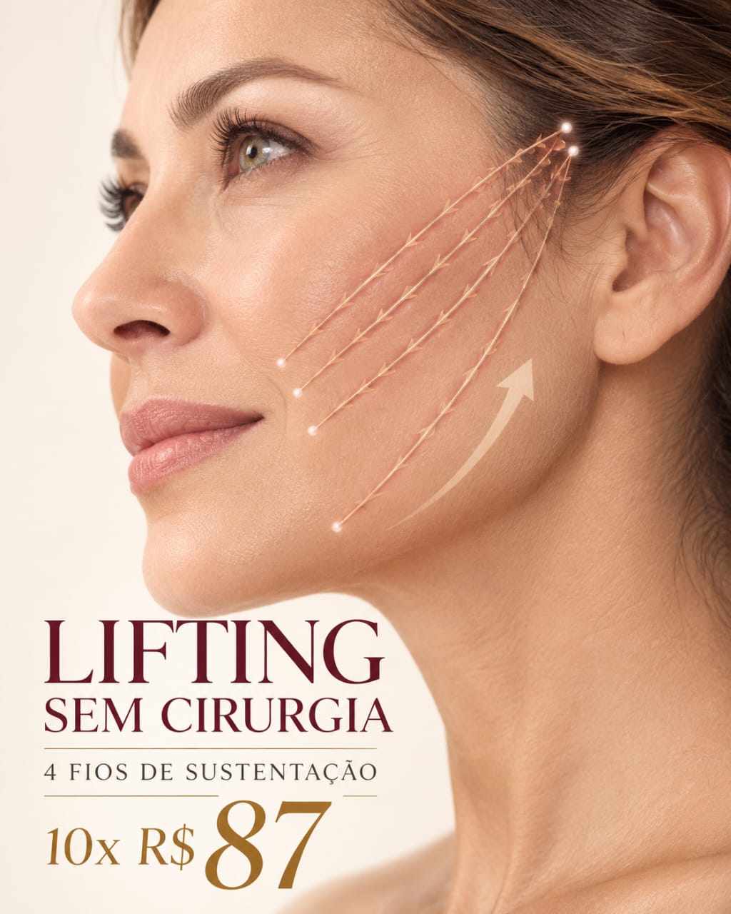 Lifting sem cirurgia com 4 fios de sustentação em 10x de R$ 87